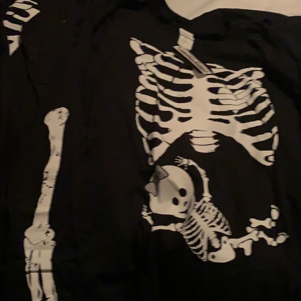 Baby girl rib cage shirt with skeleton arms